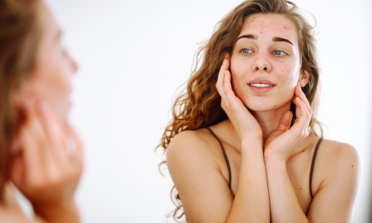 What Is Photosensitivity in Skincare? — By Skin Coach Isha Nagrra